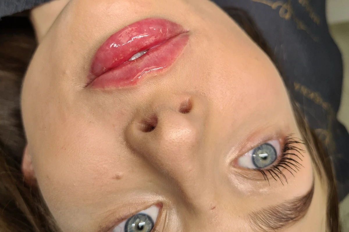 MODELOWANIE UST - Modelowanie ust 1ml